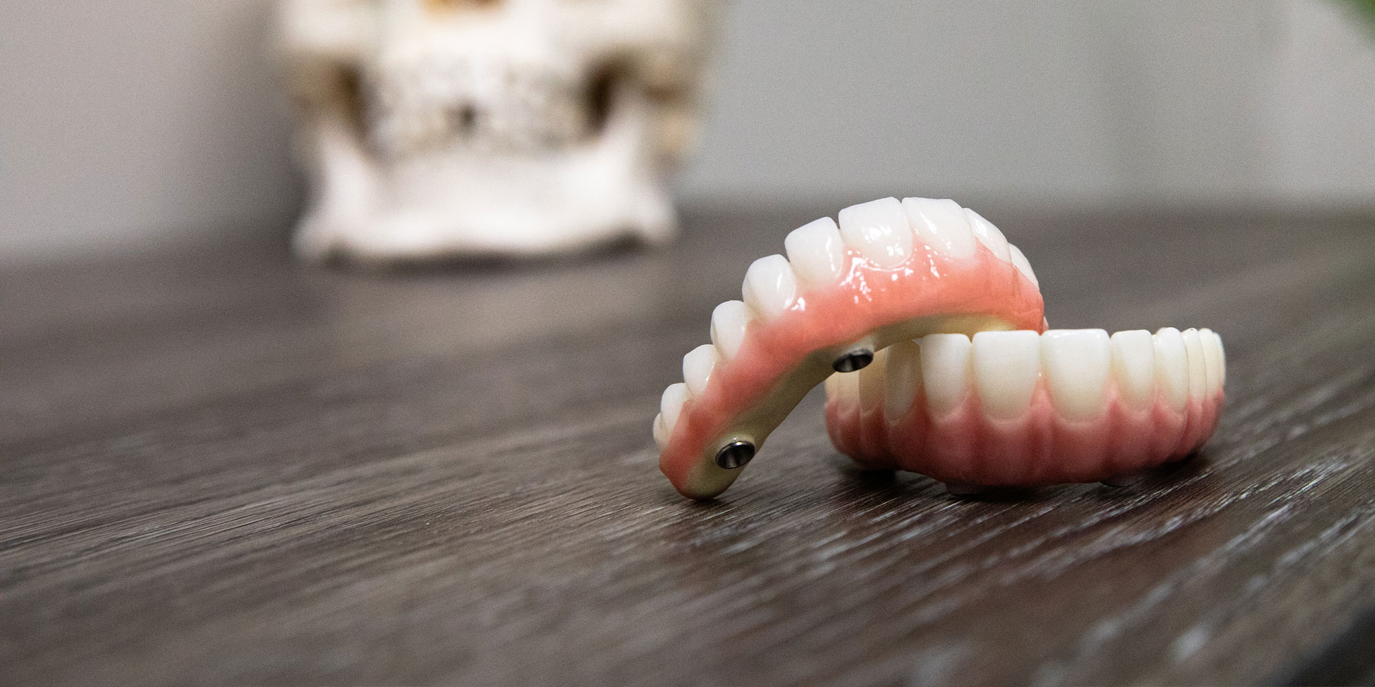 close up of dental implant model