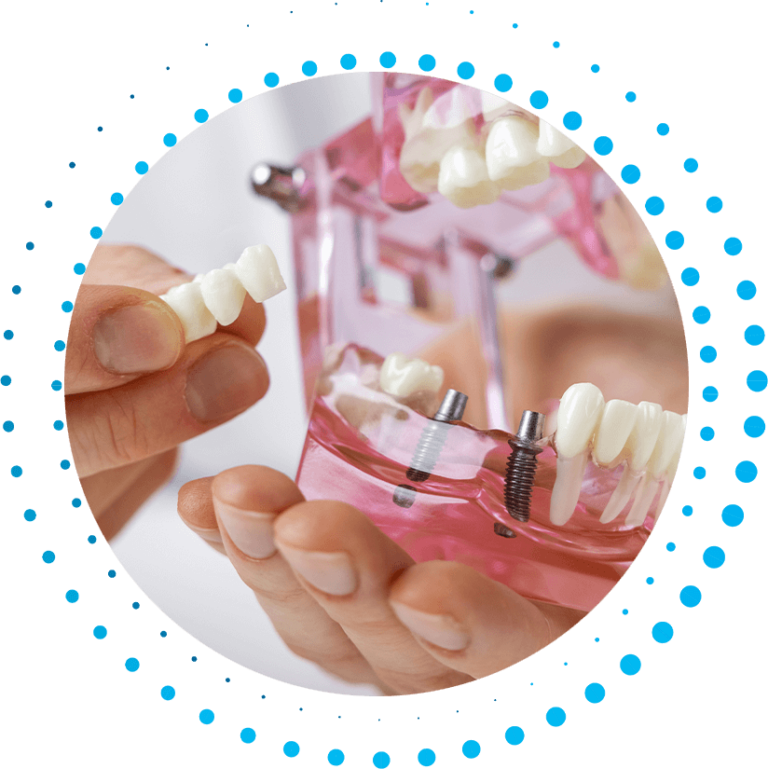 Zirconia Fixed Bridge Kearney, NE Grand Island, NE Heartland Oral