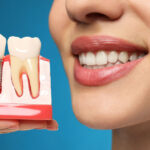 A woman smiles, holding a dental implant model showing the post and crown, emphasizing the natural, restored look and aesthetic benefits.